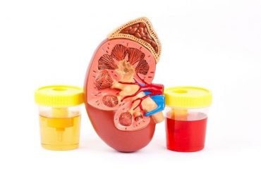 Αιματουρία