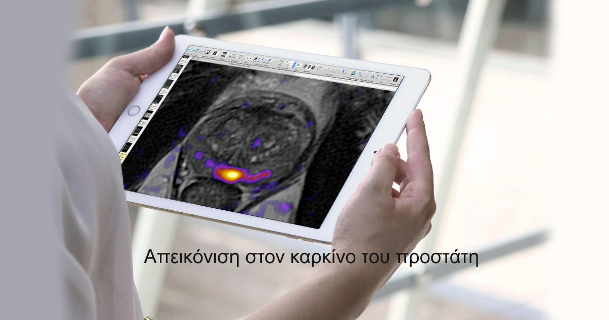 Απεικόνιση προστάτη