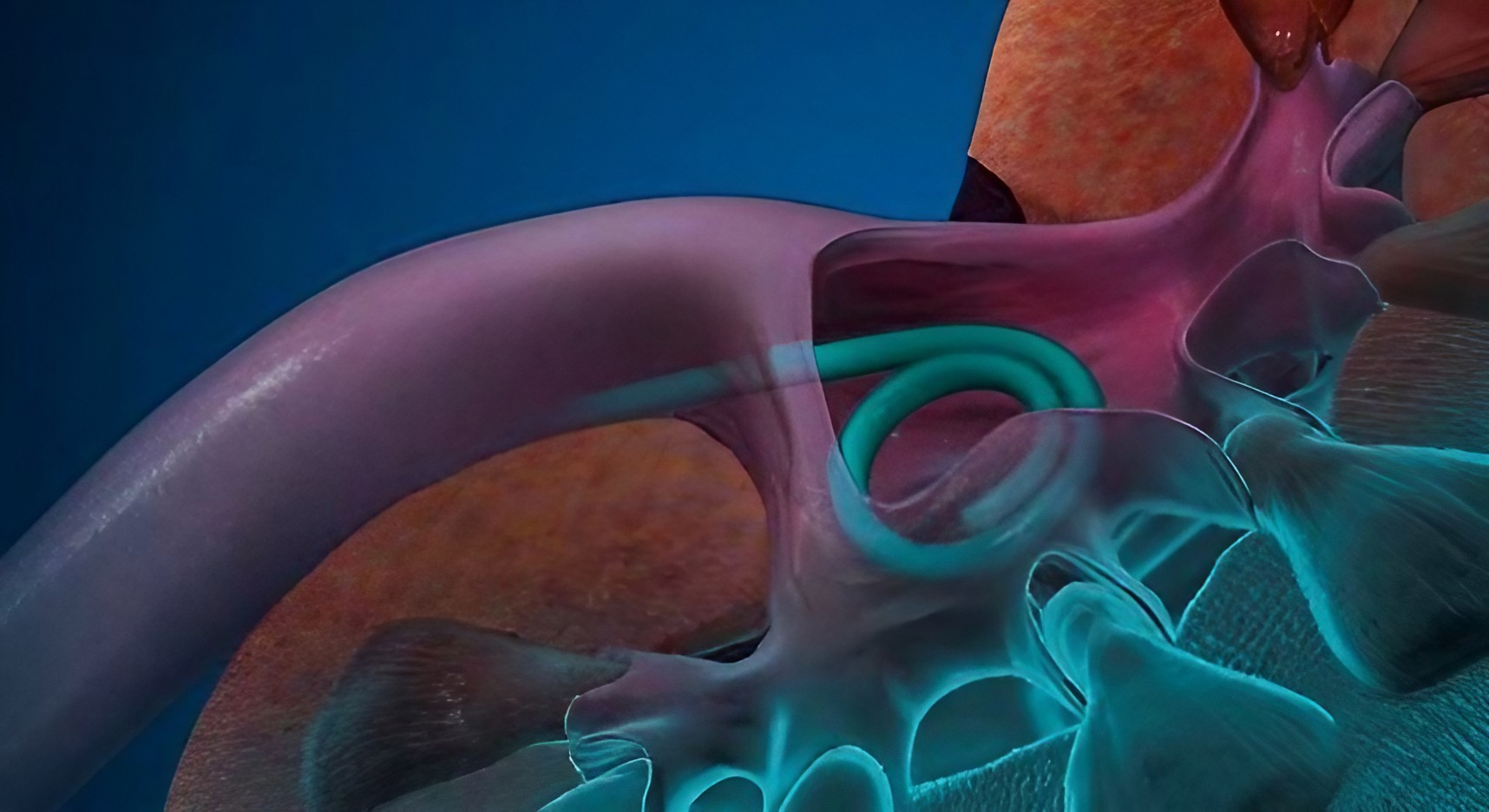 Ουρητηρικά stents