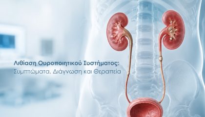Λιθίαση Ουροποιητικού Συστήματος: Συμπτώματα, Διάγνωση και Θεραπεία