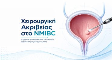 Χειρουργική ακριβείας για την αντιμετώπιση του μη διηθητικού καρκίνου της ουροδόχου κύστης